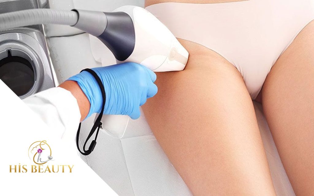 Bikini Bölgesi Lazer Epilasyon Sakarya