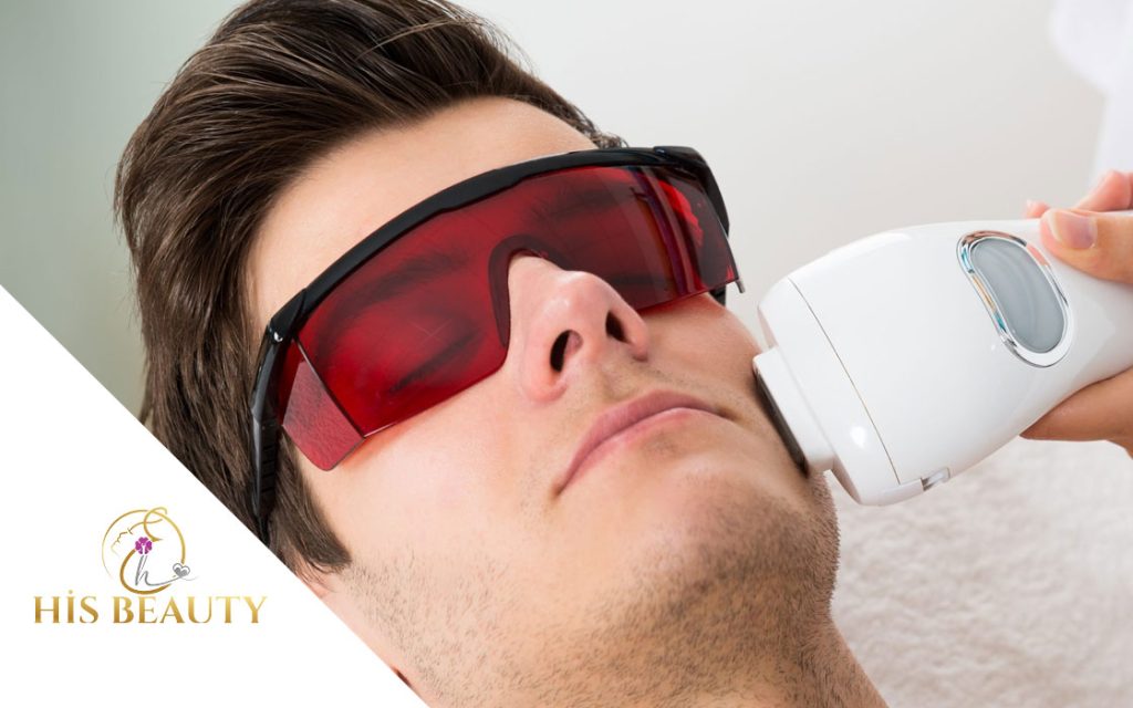 sakal lazer epilasyon